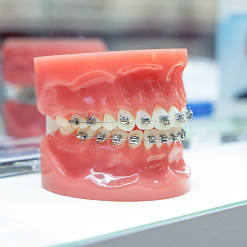 Clínica Chalet Dental especialista en ortodoncia